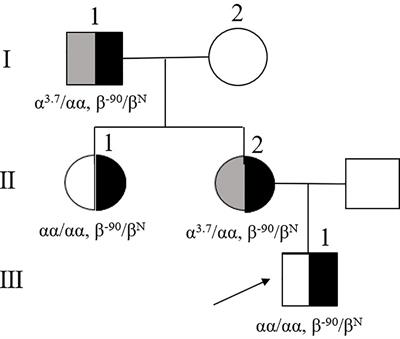 The research for various genotypes and phenotypes related to rare -90 (C>T) β-thalassemia mutation in Ganzhou city, Southern China